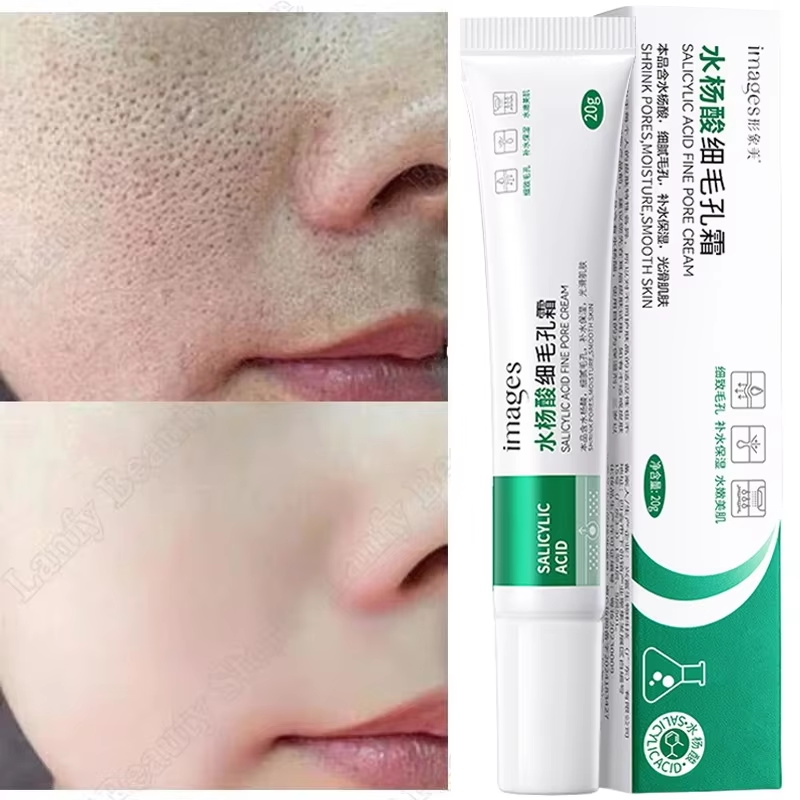 Salicylic Acid Blackhead Remover - サリチル酸毛穴クリアクリーム毛穴縮小黒ずみ除去ニキビ除去美白保湿スムーススキンケア韓国製品