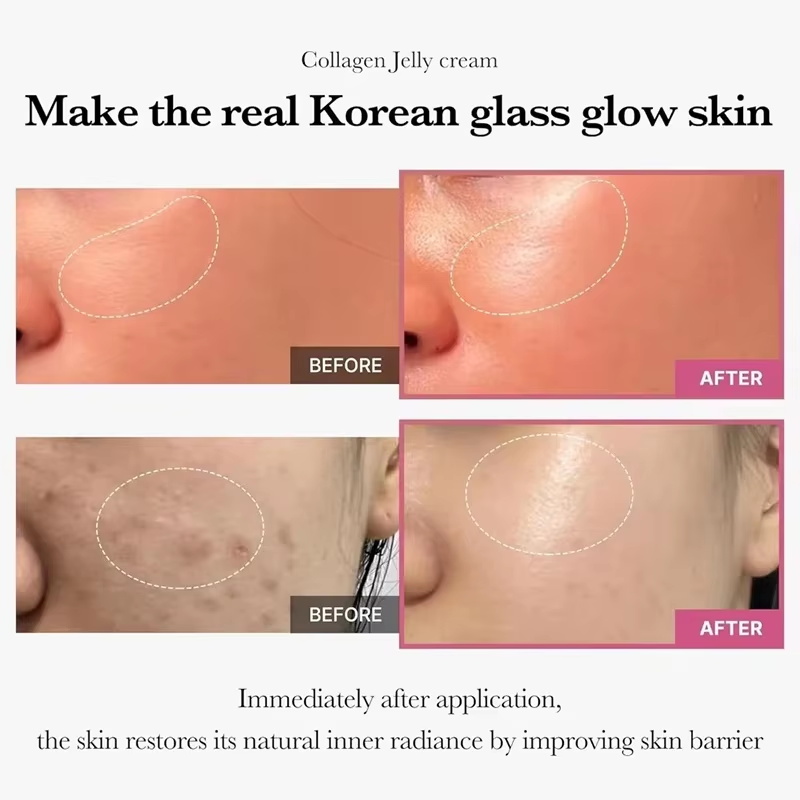 100 グラムゼリーフェイスクリームコラーゲンソフトスパ栄養 - Niacinamide Pore Shrinking Essence のレビューと価格