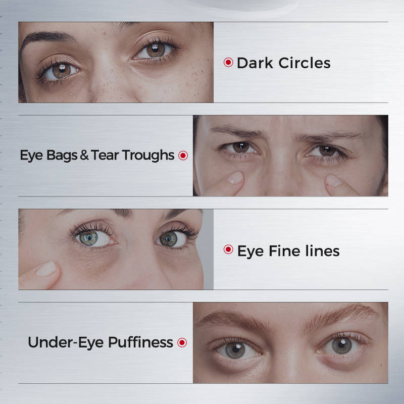 くま用アイパッチ – コラーゲン、アセチルヘキサペプチド-8 - Collagen Under Eye Patches のレビューと価格