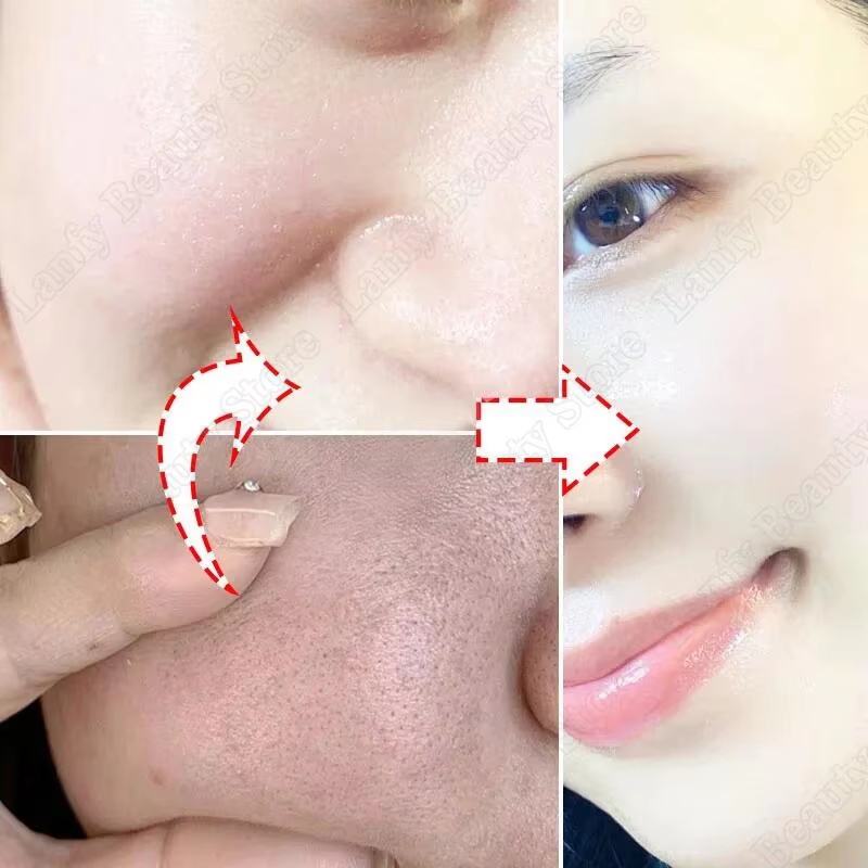 サリチル酸毛穴クリアクリーム毛穴縮小黒ずみ除去ニキビ除去美白 - Salicylic Acid Blackhead Remover のレビューと価格